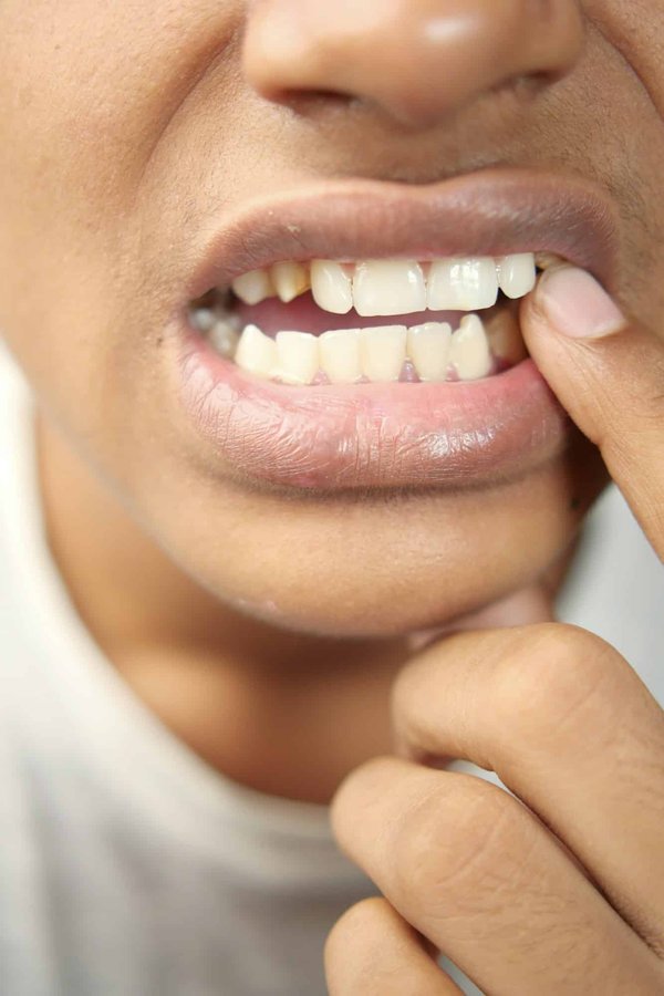 Le Centre dentaire GK propose-t-il des soins pour les dents sensibles ?